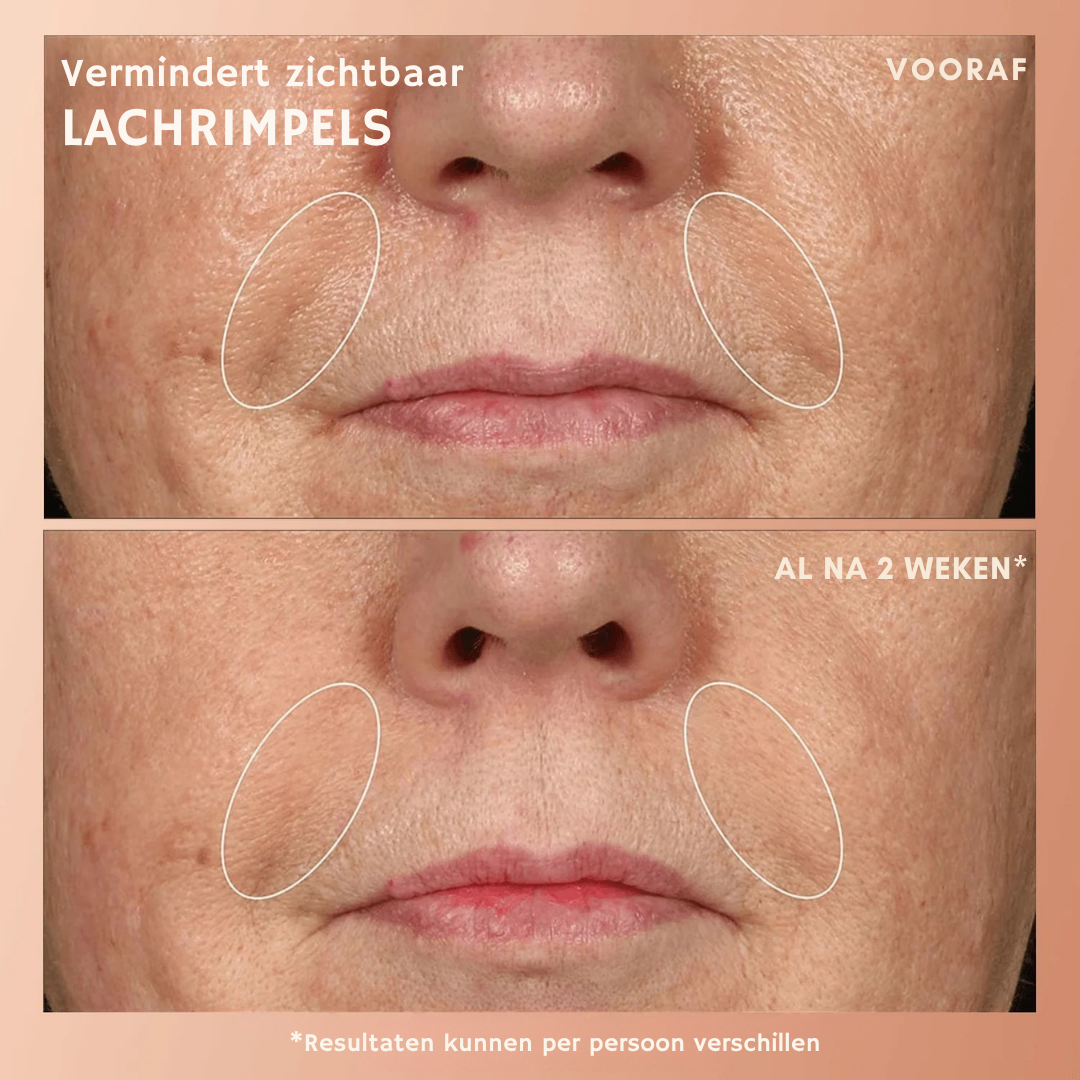 Youth 1700 Anti-Aging Serum